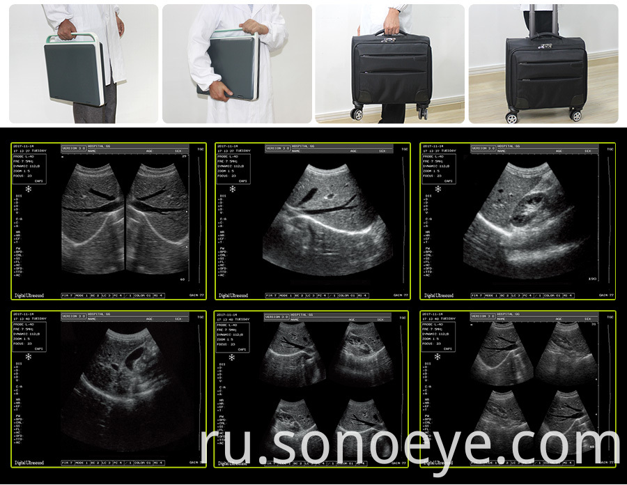 Digital Trolley Ultrasound Scanner